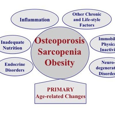 Osteoporosis Sarcopenia Obesity graphic